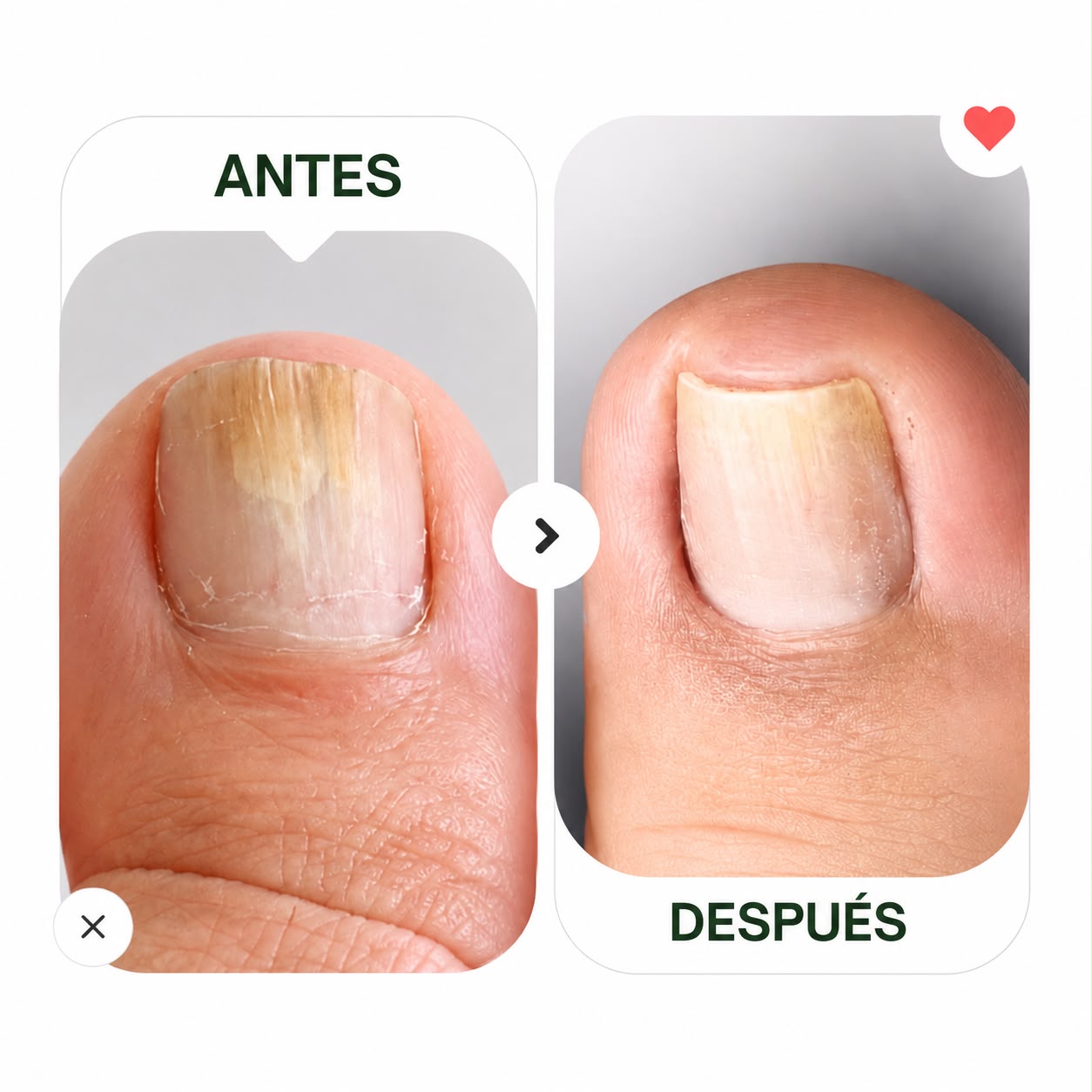 Comparación de pies antes y después