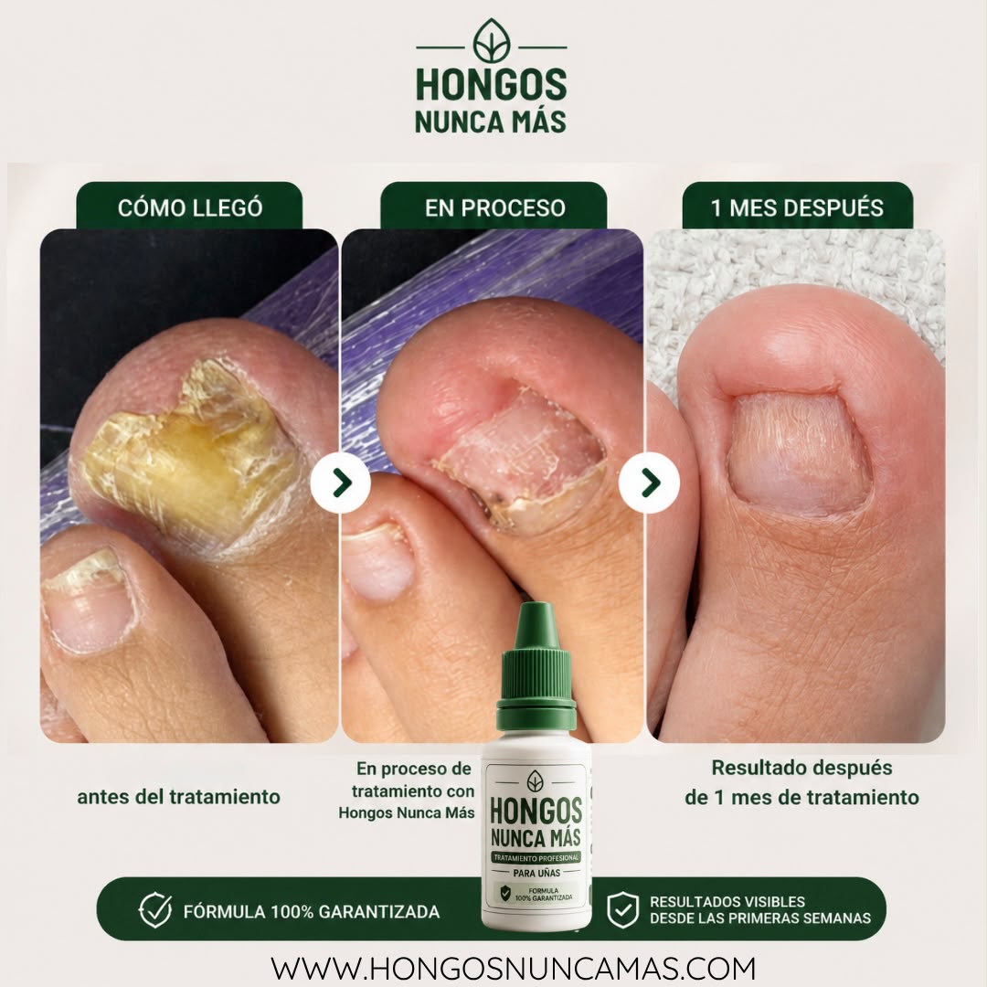 Frasco de Hongos Nunca Más 15 ml